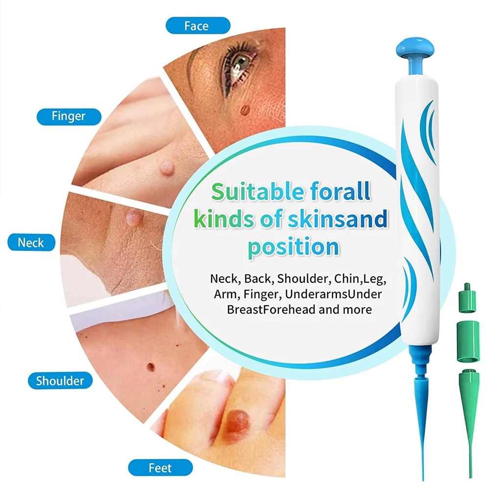 2 IN 1 Auto Micro Skin Tag Rem - Skincare Ingredients Checker 评论和价格