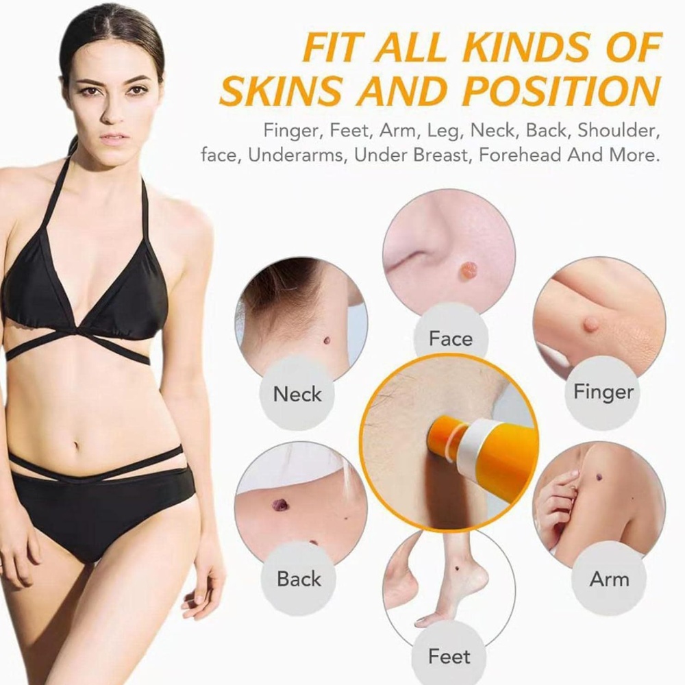Auto Skin Tag Removal Kit For  - Skincare Ingredients Checker 评论和价格