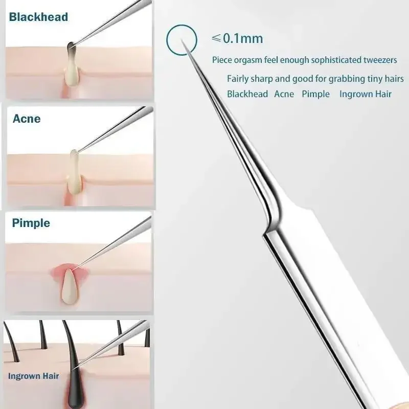 11Pcs/Set Acne Needle Blackhea - Skincare Ingredients Checker 评论和价格