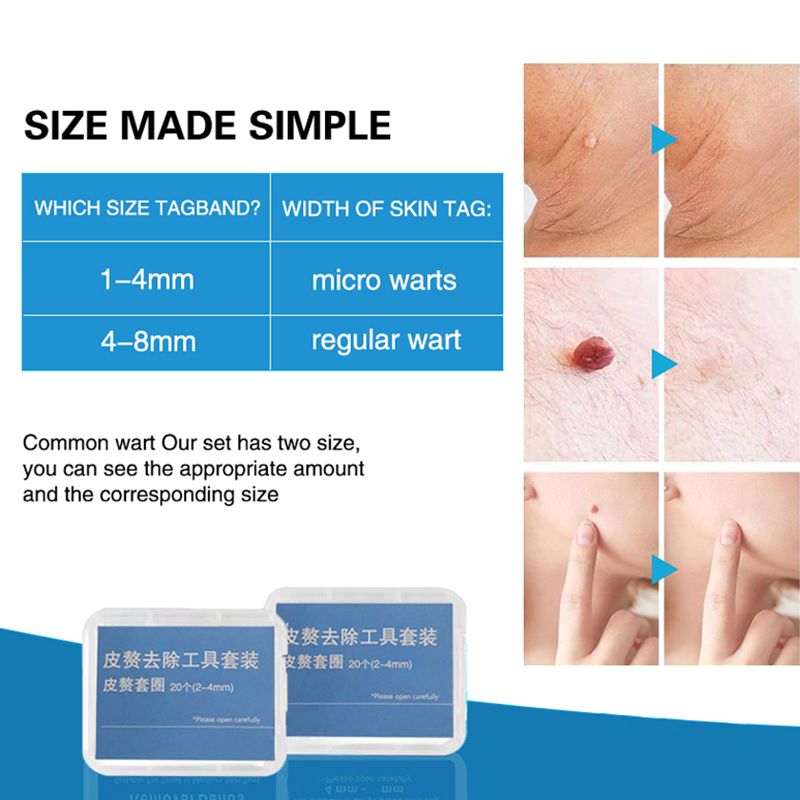 20pcs/Box Flesh Nevus Removal  - Skincare Ingredients Checker 评论和价格